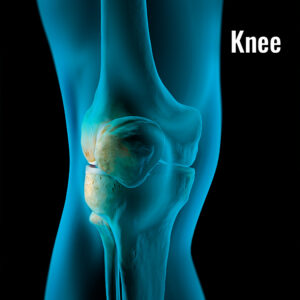 arthrex-knee